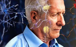 楊永利博士研發的腦波康復耳機能有效防止老人癡呆？